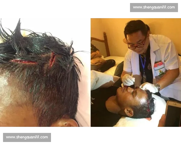 罗宾对决播求巅峰之战技术风格碰撞引爆拳坛热议世界级擂台荣誉之争